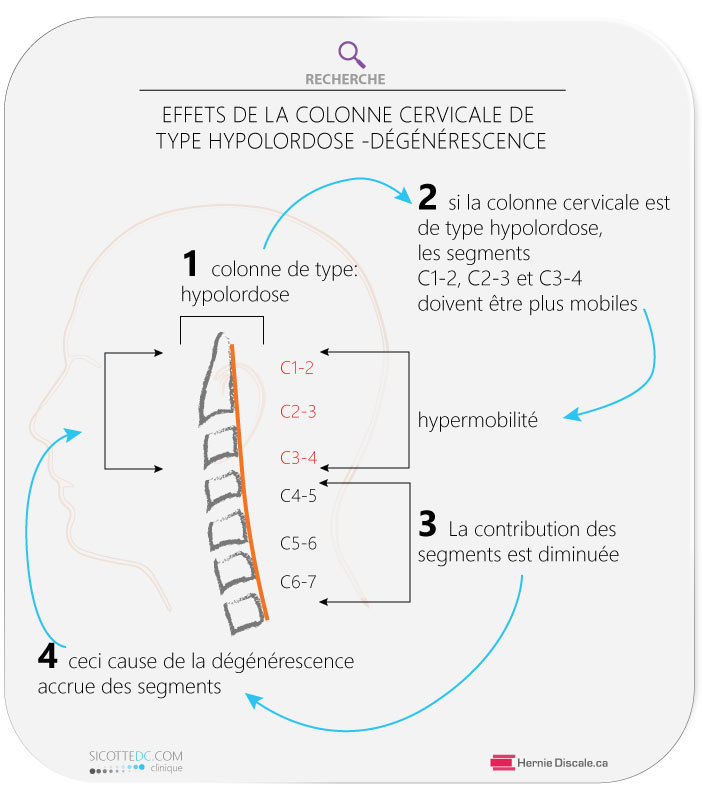 Hypermobilitée de la colonne vertebrale cervicale C2-C3-C4 et les effest sur le discarthrose.