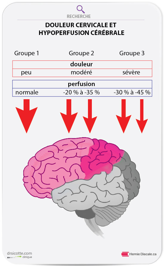 Graphique démontrant l'hypoperfusion cérébrale et les douleurs cervicale.