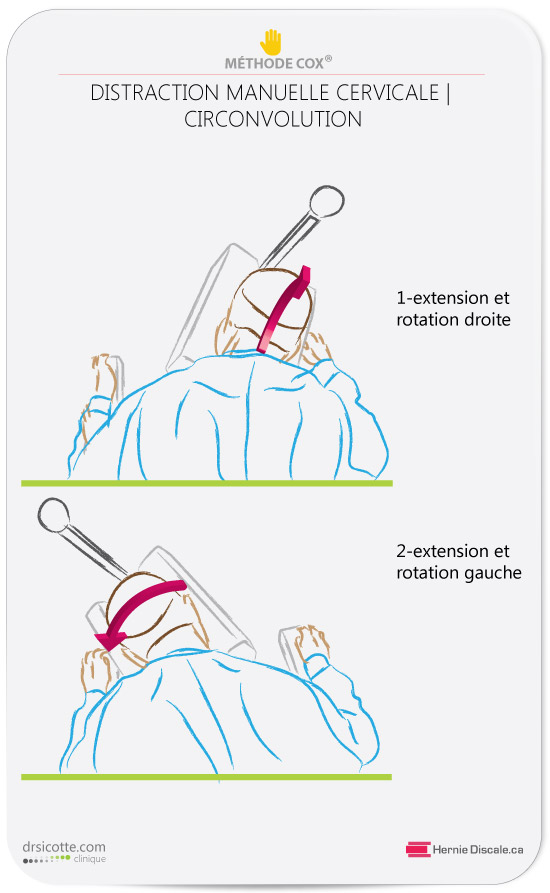 La méthode Cox en flexion latérale et circonvolution cervicale pour douleur cervicale et arthrose facettaire.