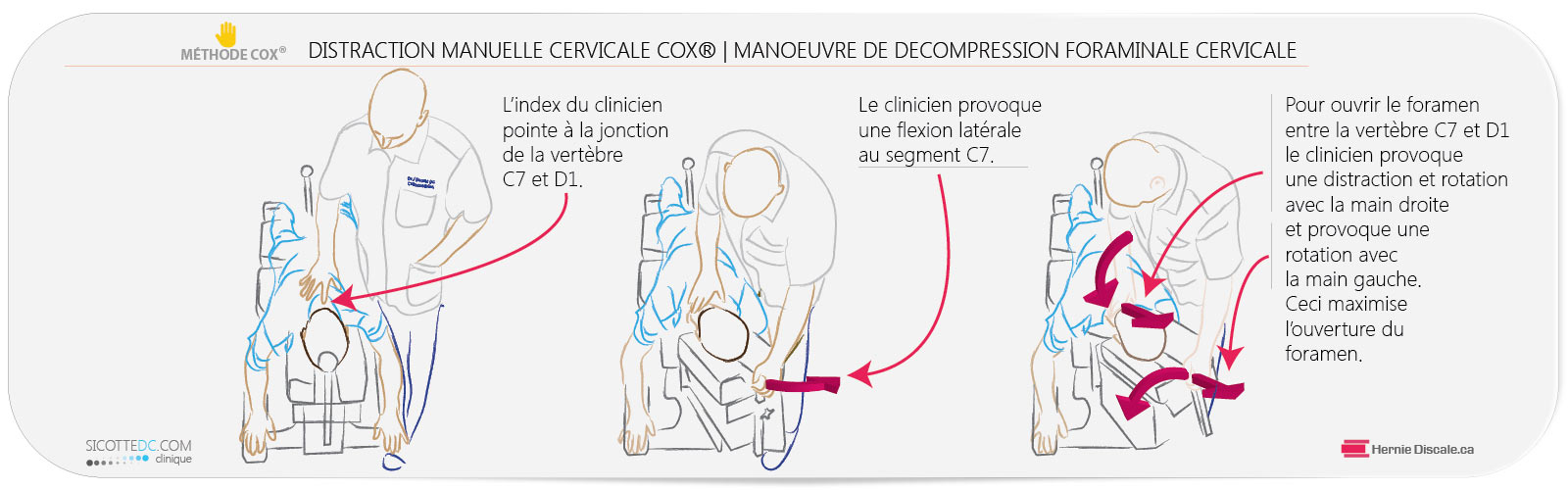 Manoeuvre de décompression foraminale avec la méthode Cox une distraction traitement des segments cervicaux C6-C7.