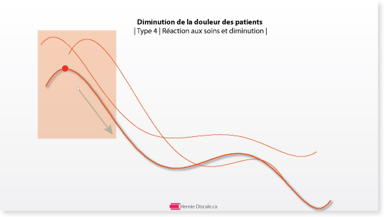 diminuation-douleur-hernie-discale-type-4-progression-reaction-traitement
