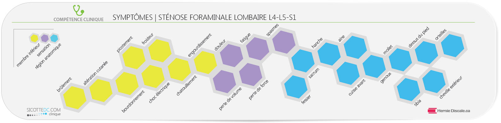 La liste des symptômes de la sténose foraminale lombaire: L4-L5-S1